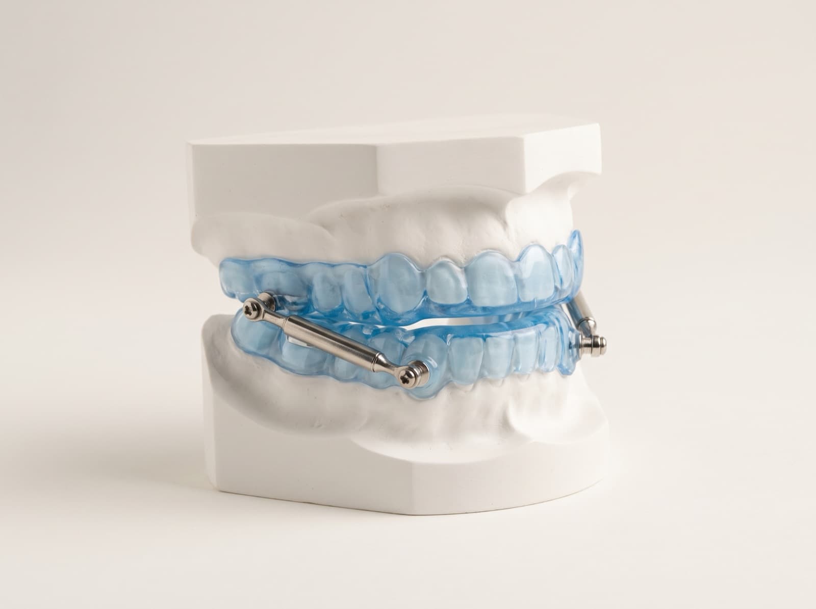 Custom blue oral appliance for sleep apnea fitted on a dental model
